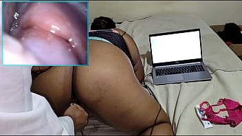 Explorando A Intimidade: Ginecologista Registra Com Câmera Interna E Finaliza Com Prazer Intenso Na Vulva Da Paciente